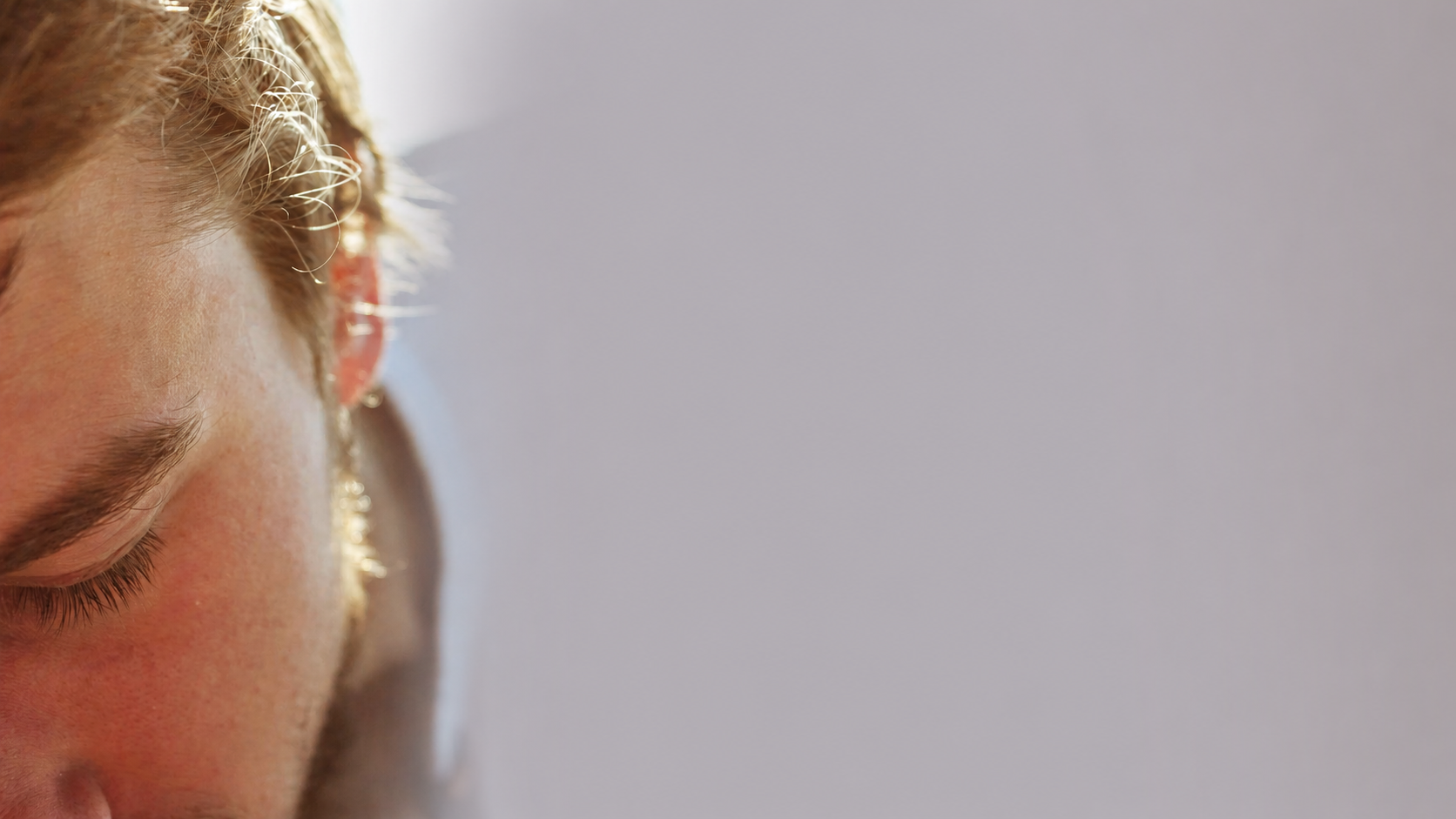 Male Hair Transplant in Shirdi